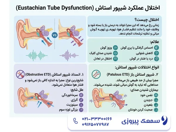 اختلال عملکرد شیپور استاش